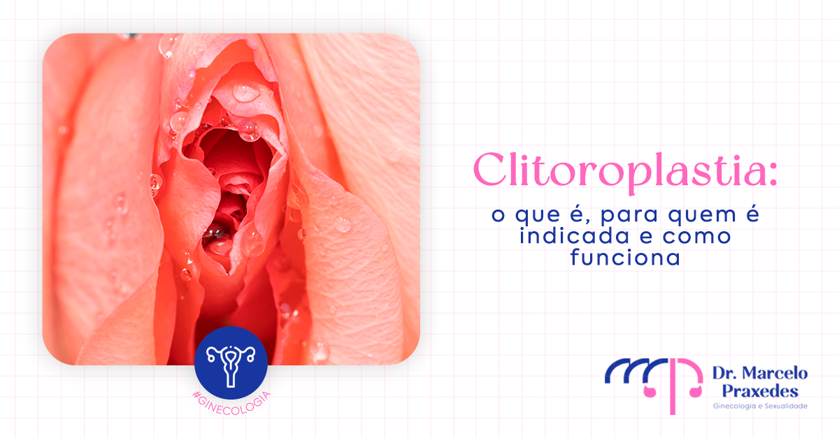 Clitoroplastia: O Que É, Como Funciona e O Que Esperar do Procedimento