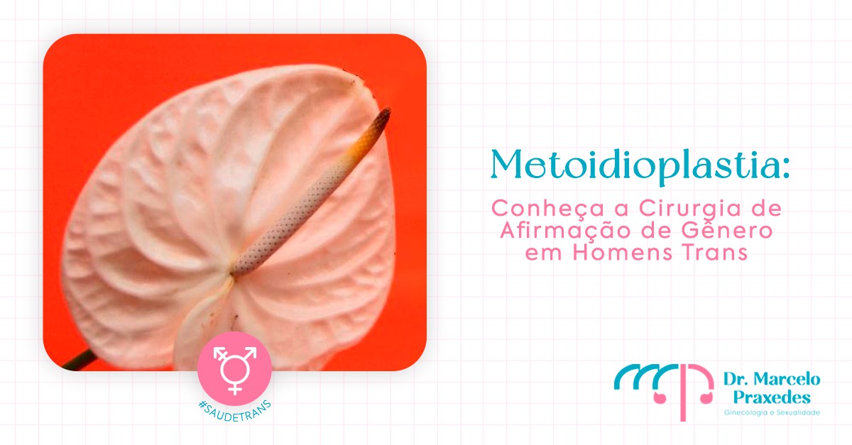 Metoidioplastia: Conheça a Cirurgia de Afirmação de Gênero em Homens Trans
