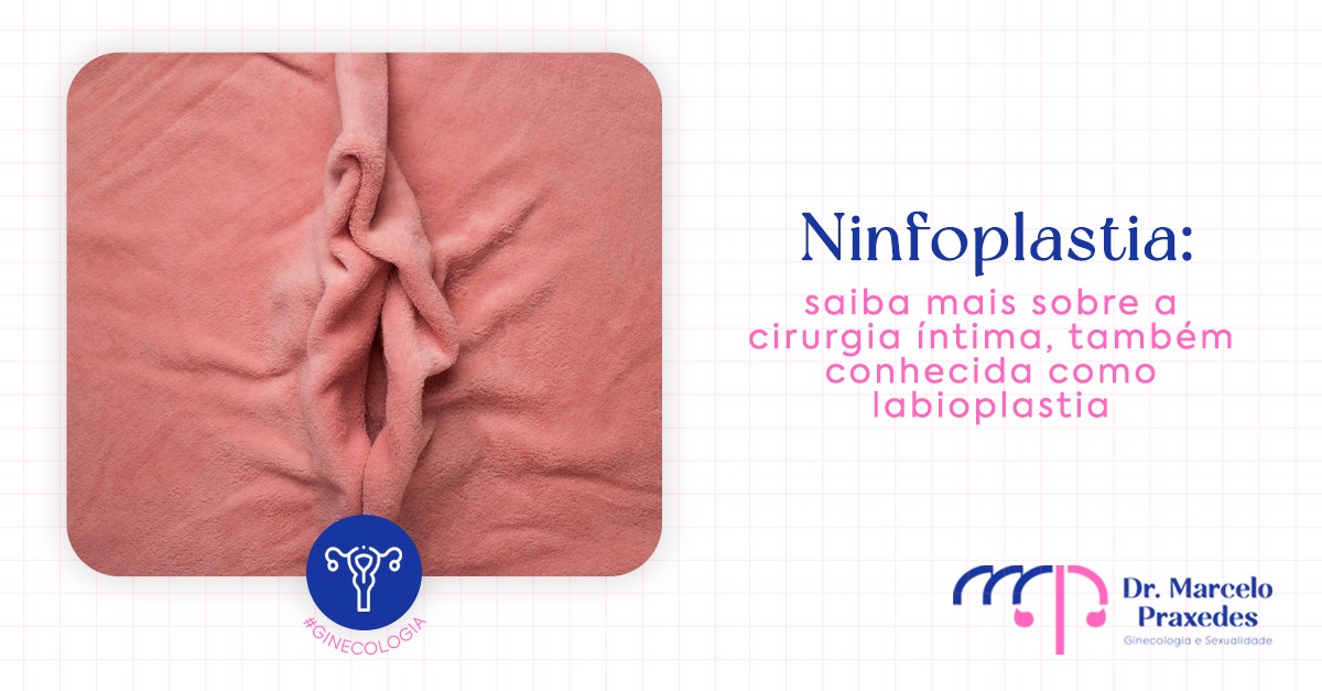 Ninfoplastia: Saiba Mais Sobre a Cirurgia Íntima Também Conhecida como Labioplastia