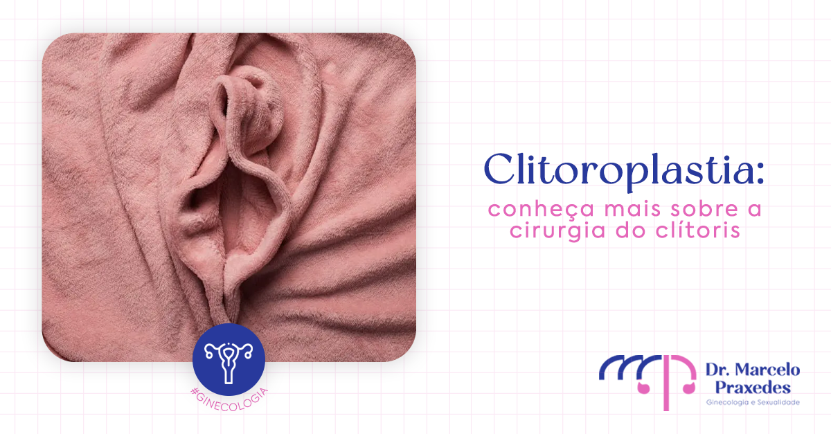 Clitoroplastia: conheça mais sobre a cirurgia do clítoris