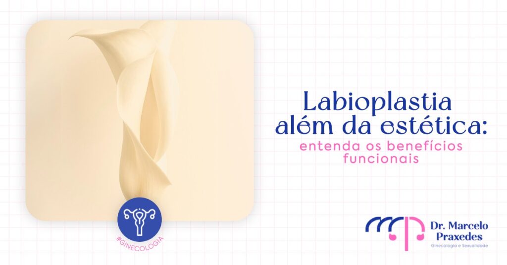 Labioplastia além da estética: entenda os benefícios funcionais