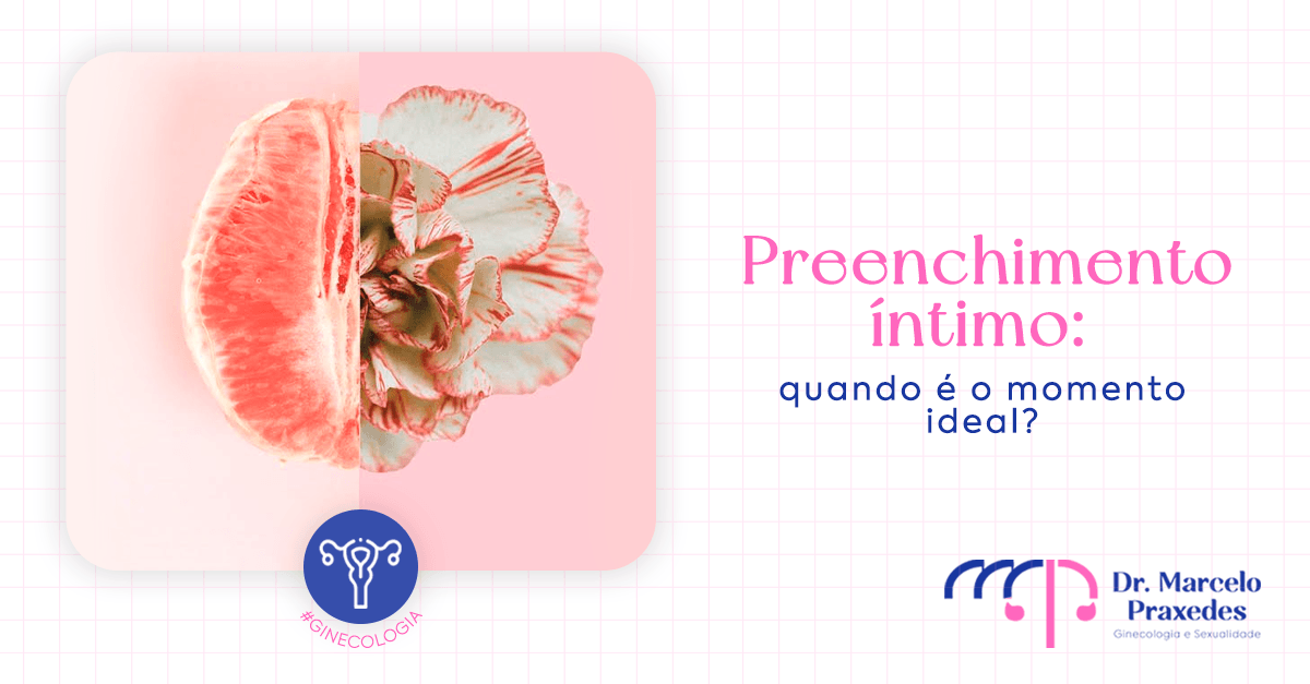 Preenchimento íntimo: quando é o momento ideal?