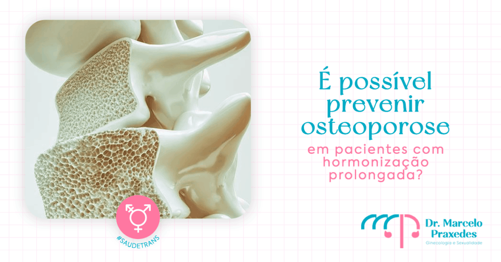 É possível prevenir osteoporose em pacientes com hormonização prolongada?