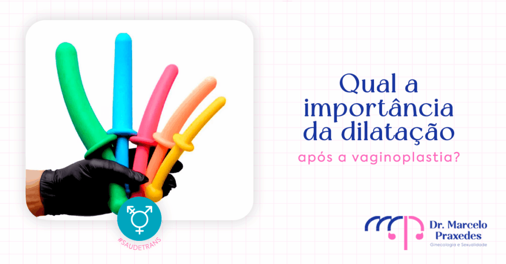 Qual a importância da dilatação após a vaginoplastia?