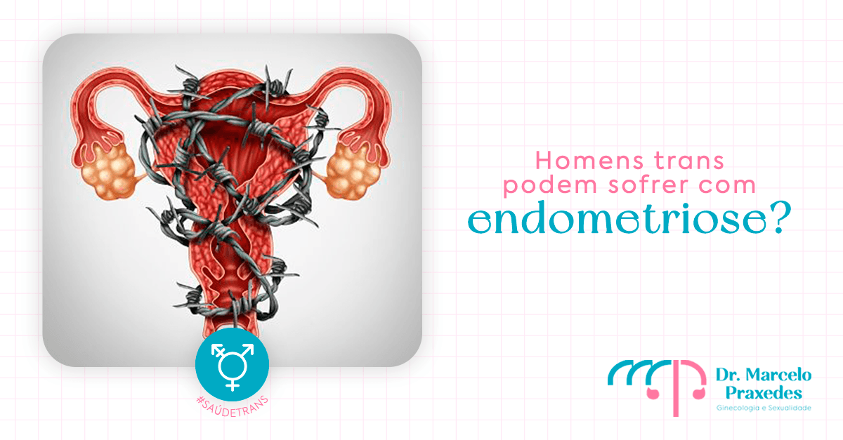 Homens trans podem sofrer com endometriose?