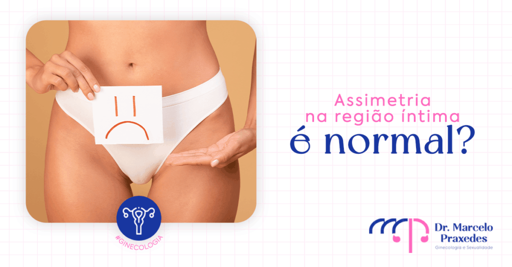 Assimetria na região íntima é normal?