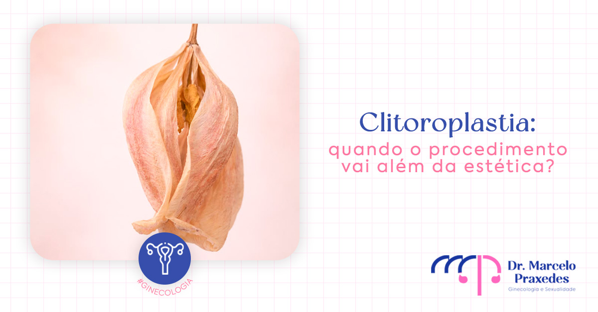 Clitoroplastia: quando o procedimento vai além da estética?