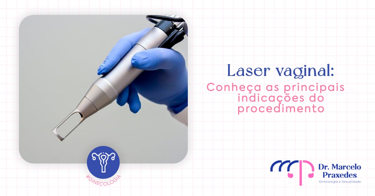 Laser vaginal: conheça as principais indicações do procedimento!