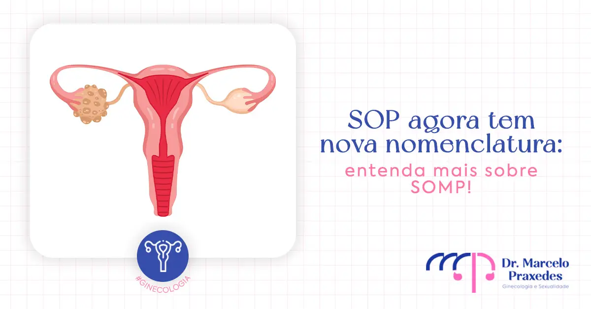 SOP agora tem nova nomenclatura: entenda mais sobre SOMP!