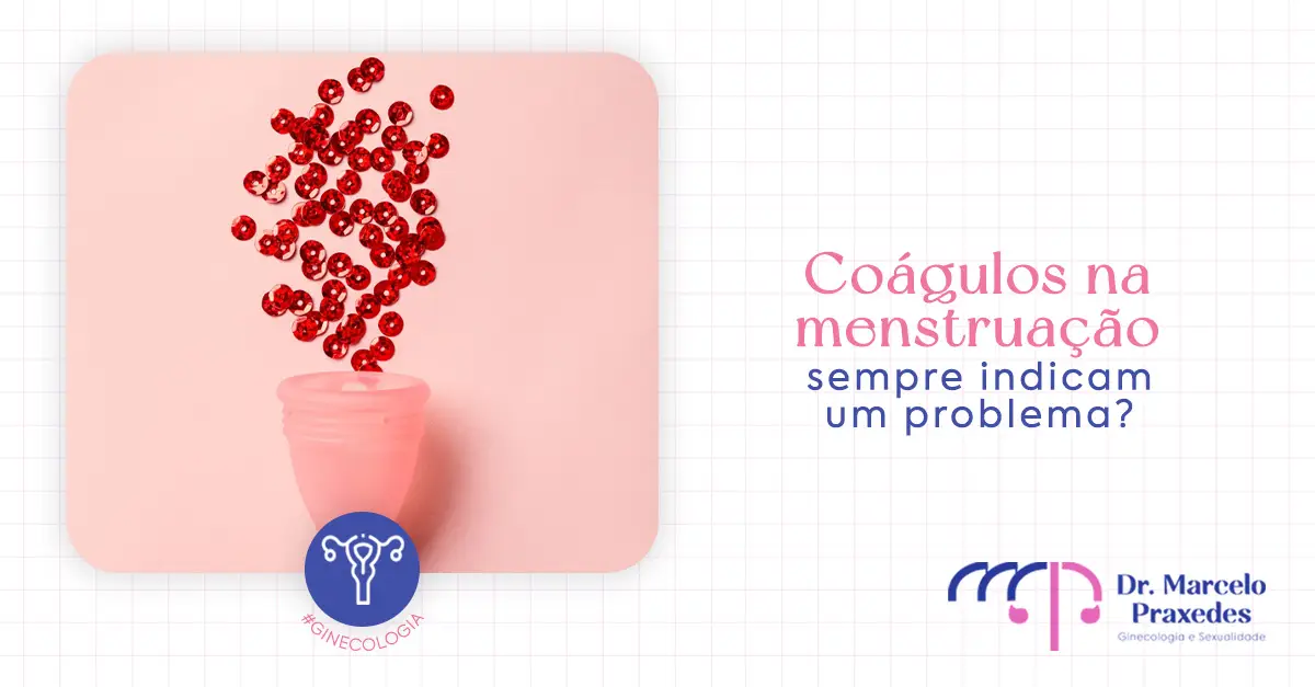 Coágulos na menstruação sempre indicam um problema?